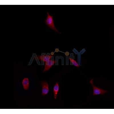 DFNA5/GSDME Antibody - DF9705 staining HepG2 by IF/ICC.