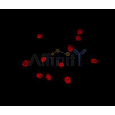 USP16 Antibody - DF9983 staining HepG2 by IF/ICC.