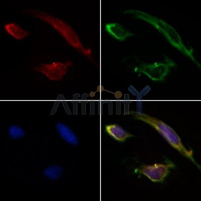 TNF Receptor I Antibody - AF0282 staining HepG2 by IF/ICC.