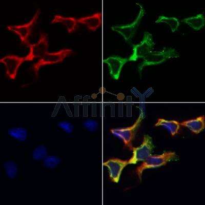 TSPAN8 Antibody - AF0362 staining Hela by IF/ICC.