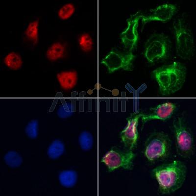 VPS72 Antibody - AF0508 staining Hela by IF/ICC.