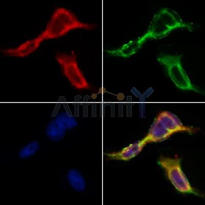 ACE2 Antibody - AF5165 staining HepG2 by IF/ICC.