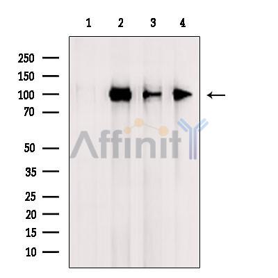 ACE2 Antibody - Western blot analysis of extracts from various samples, using ACE2 Antibody.