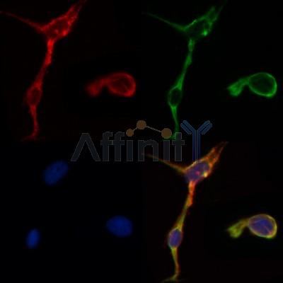 MMP2 Antibody - AF5330 staining HepG2 by IF/ICC.