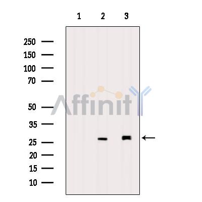 TIMP4 Antibody - Western blot analysis of extracts from various samples, using TIMP4 Antibody.