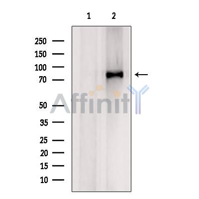 Coilin Antibody - Western blot analysis of extracts from Hela, using Coilin Antibody.