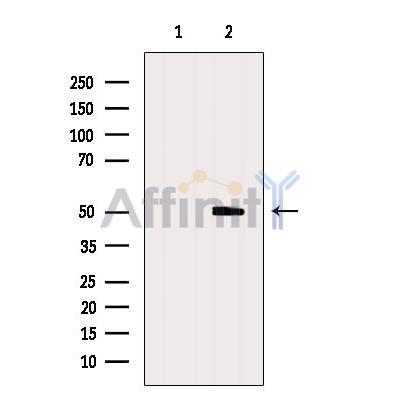 TRIM14 Antibody - Western blot analysis of extracts from Hela, using TRIM14 Antibody.