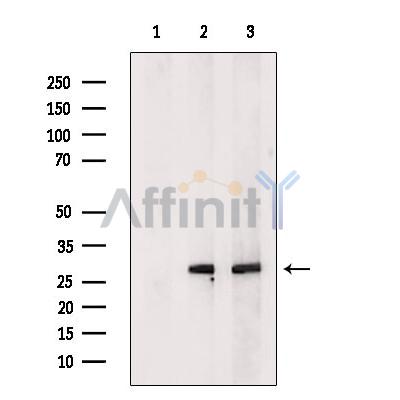 C19orf52 Antibody - Western blot analysis of extracts from various samples, using C19orf52 Antibody.