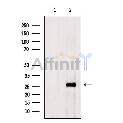 GSTT2B Antibody - Western blot analysis of extracts from RAW264.