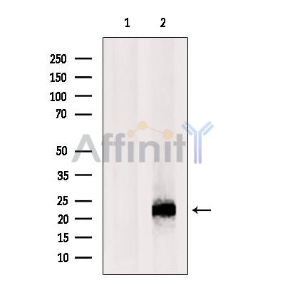 RNASEH2C Antibody - Western blot analysis of extracts from MCF7, using RNASEH2C Antibody.