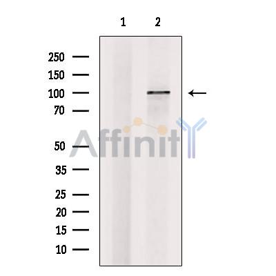 ZHX1 Antibody - Western blot analysis of extracts from Rat  liver, using ZHX1 Antibody.