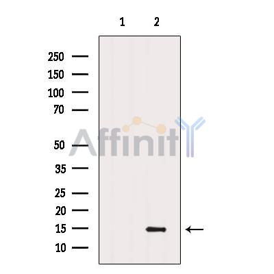CHCHD10 Antibody - Western blot analysis of extracts from Mouse  lung, using CHCHD10 Antibody.
