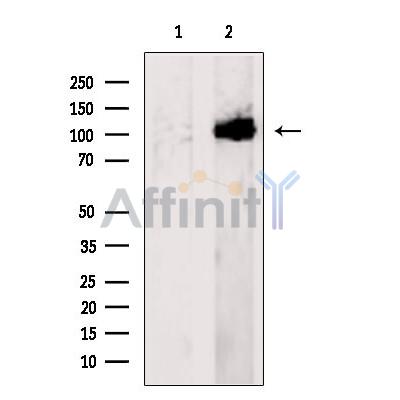 COG3 Antibody - Western blot analysis of extracts from Mouse  spleen, using COG3 Antibody.