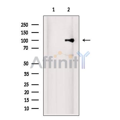 EXOSC10 Antibody - Western blot analysis of extracts from PC12, using EXOSC10 Antibody.