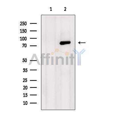 SATB2 Antibody - Western blot analysis of extracts from Hela, using SATB2 Antibody.