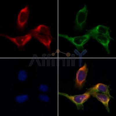 TACD2 Antibody - DF3080 staining Hela by IF/ICC.