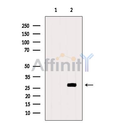 CDCA3 Antibody - Western blot analysis of extracts from Mouse  kidney, using CDCA3 Antibody.