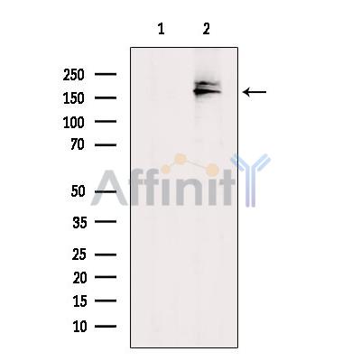 MRP7 Antibody - Western blot analysis of extracts from A2780, using MRP7 Antibody.