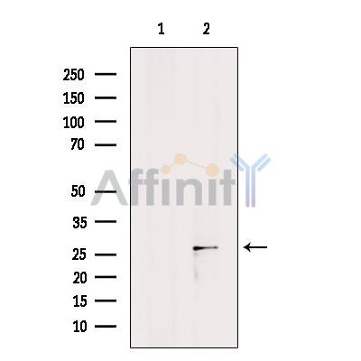 PSMB1 Antibody - Western blot analysis of extracts from A2780, using PSMB1 Antibody.