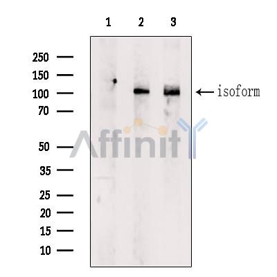 DST Antibody - Western blot analysis of extracts from various samples, using DST Antibody.