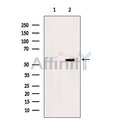 GNA15 Antibody - Western blot analysis of extracts from B16F10, using GNA15 Antibody.