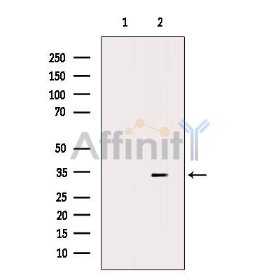 HAVCR2 Antibody - Western blot analysis of extracts from Pc12, using HAVCR2 Antibody.