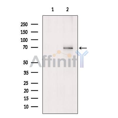 YY1 Antibody - Western blot analysis of extracts from A2780, using YY1 Antibody.