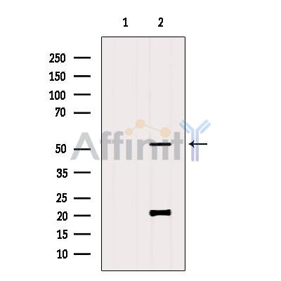 FucT-IV Antibody - Western blot analysis of extracts from B16F10, using FucT-IV Antibody.