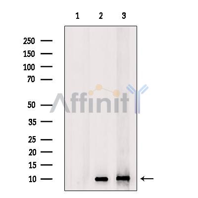 GnRH I Antibody - Western blot analysis of extracts from various samples, using GnRH I Antibody.