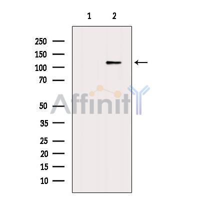 TSH2 Antibody - Western blot analysis of extracts from Hybridoma cells, using TSH2 Antibody.