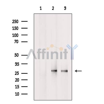 CLDN18 Antibody - Western blot analysis of extracts from various samples, using CLDN18 Antibody.
