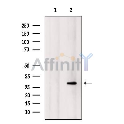 NOL7 Antibody - Western blot analysis of extracts from Mouse  muscle, using NOL7 Antibody.