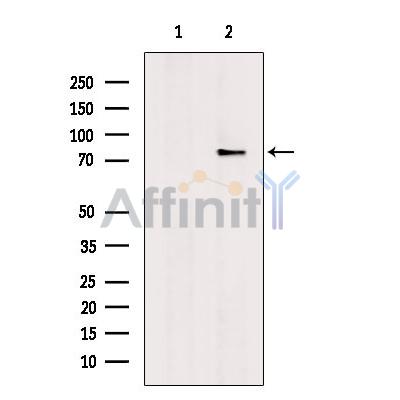 FOXP4 Antibody - Western blot analysis of extracts from Rat  brain, using FOXP4 Antibody.