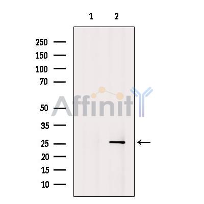 OIP5 Antibody - Western blot analysis of extracts from A2780 cells, using OIP5 Antibody.