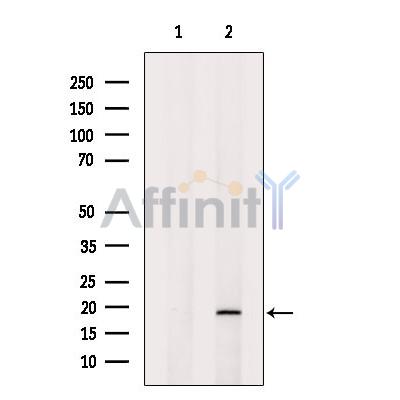 SNAPIN Antibody - Western blot analysis of extracts from Mouse  kidney, using SNAPIN Antibody.