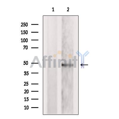 TRBP Antibody - Western blot analysis of extracts from MCF7, using TRBP Antibody.