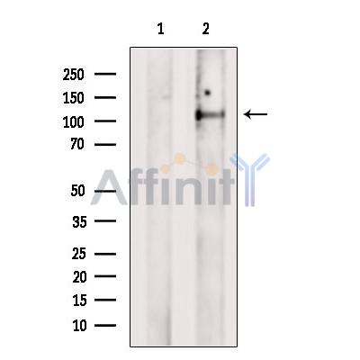 FAM65B Antibody - Western blot analysis of extracts from B16F10 cells, using FAM65B Antibody.