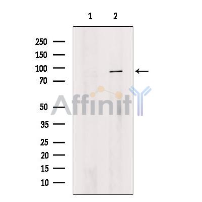 Oligophrenin 1 Antibody - Western blot analysis of extracts from Rat  brain, using Oligophrenin 1 Antibody.