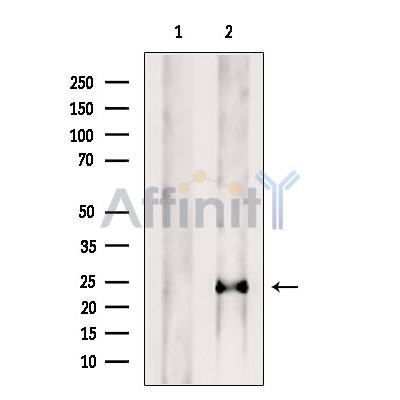 PTP4A1/PRL1 Antibody - Western blot analysis of extracts from B16F10 cells, using PTP4A1/PRL1 Antibody.