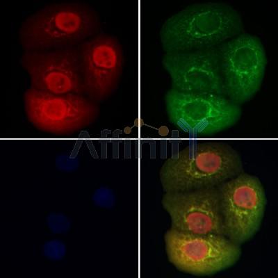 BCL9 Antibody - DF12515 staining Hela cells by IF/ICC.