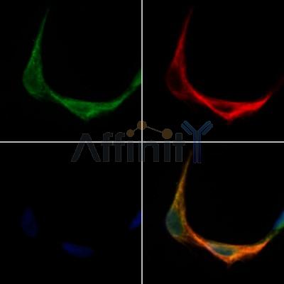 TM158 Antibody - DF12531 staining Hela cells by IF/ICC.