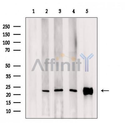 ARL15 Antibody - Western blot analysis of extracts from various samples, using ARL15 Antibody.