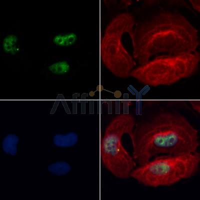 BBX Antibody - DF12568 staining Hela cells by IF/ICC.