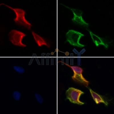 CCDC120 Antibody - DF12577 staining Hela cells by IF/ICC.