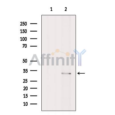 CHMP2B Antibody - Western blot analysis of extracts from Colo205, using CHMP2B Antibody.