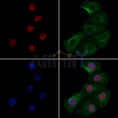 COMMD5 Antibody - DF12584 staining Hela cells by IF/ICC.