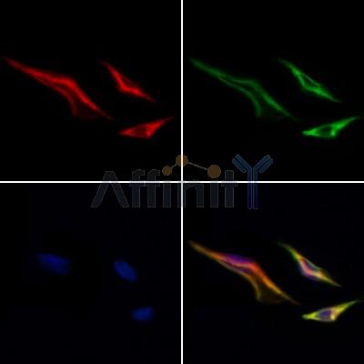MTCH2 Antibody - DF12663 staining Hela cells by IF/ICC.