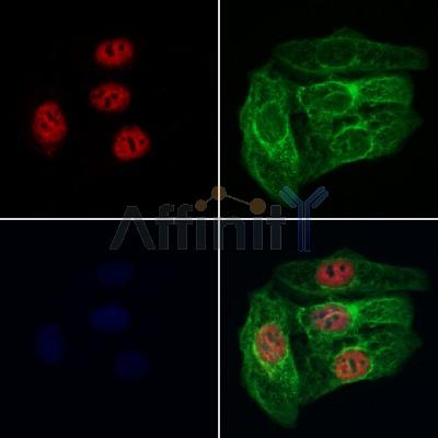 RABL3 Antibody - DF12717 staining Hela cells by IF/ICC.