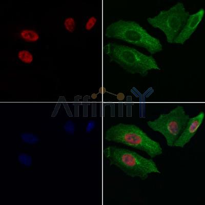 RARG Antibody - DF12718 staining Hela cells by IF/ICC.