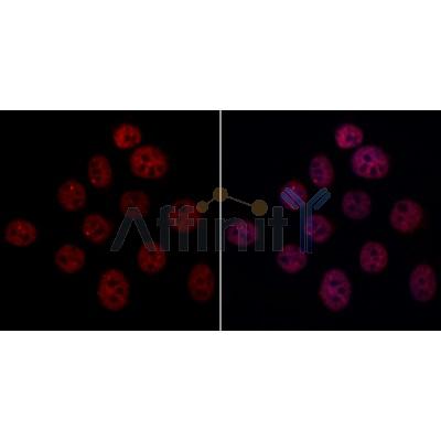 ARIH2 Antibody - DF12832 staining HeLa cells by IF/ICC.